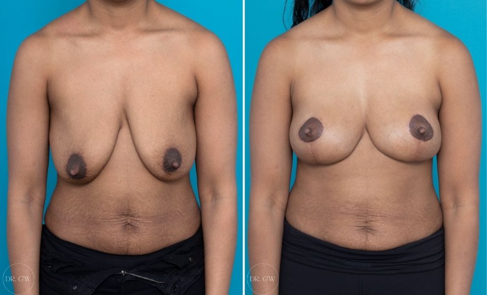 daniel joza recommends perky black titties pic