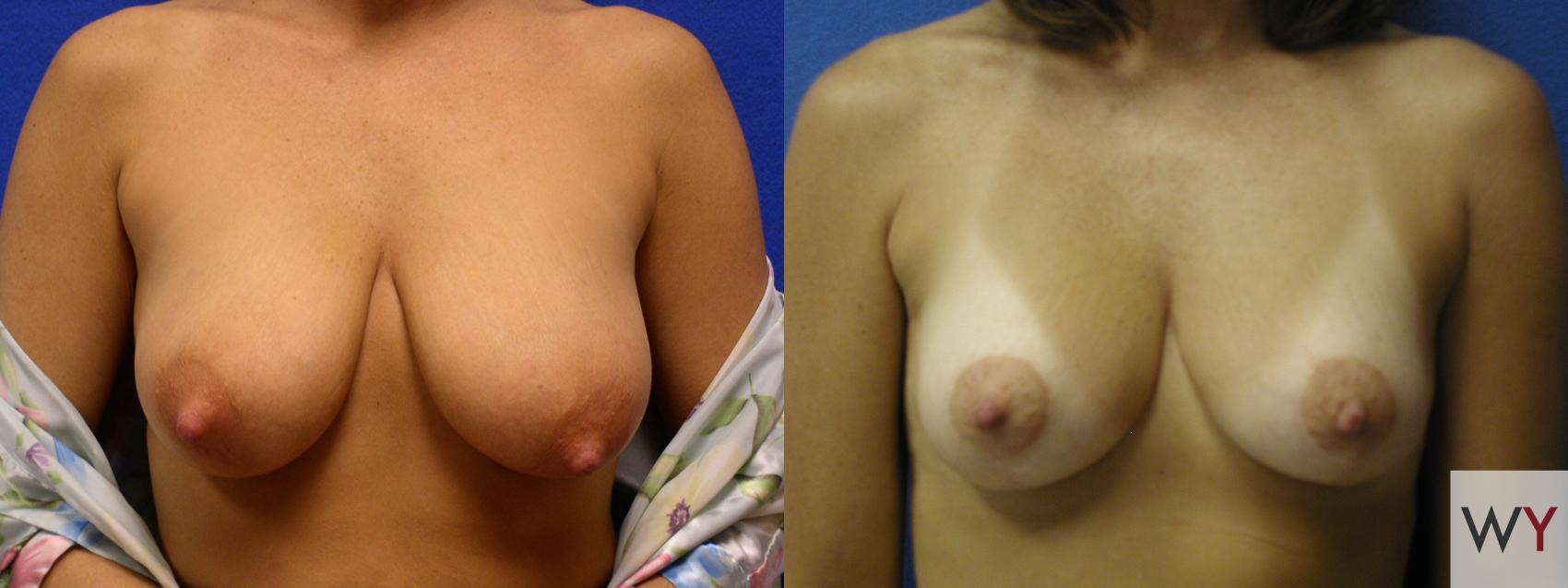 denise bouska share floopy tits photos