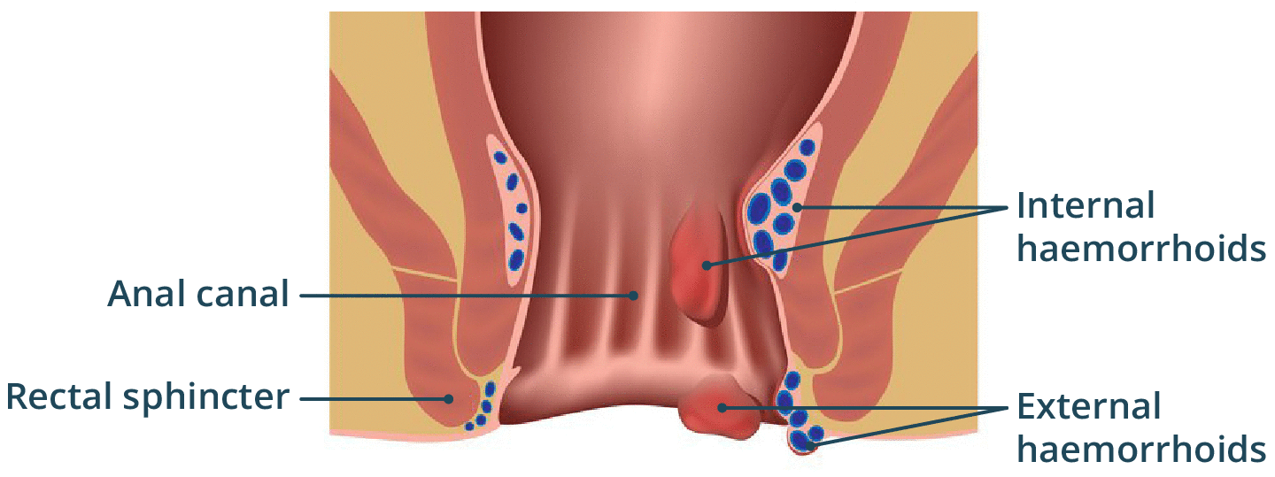 april oniel recommends anal pain face pic