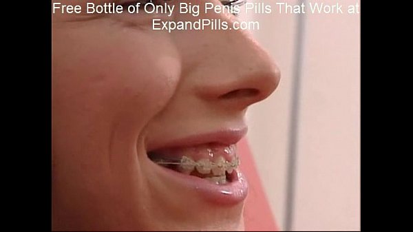 chongkho chaiyavong recommends first time anal with braces pic