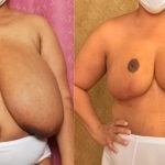 Colombian pornostar snow plow Mature Empty Tits frozen mastu
